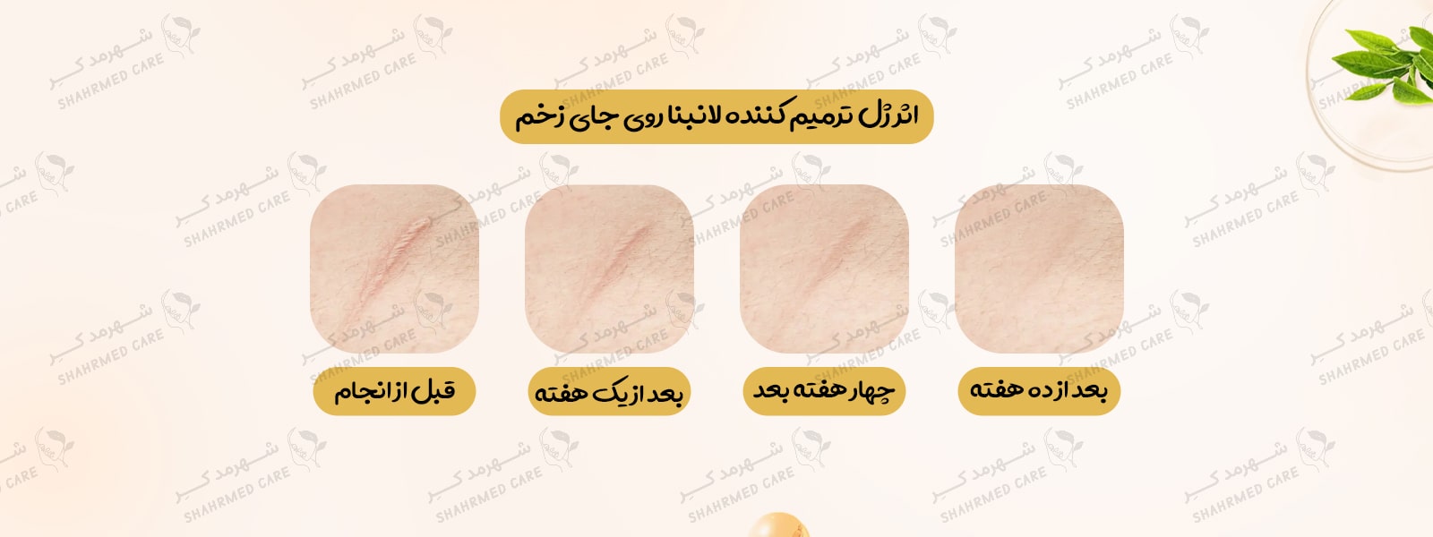 ژل ترمیم کننده 30 گرمی رفع جای جوش و آکنه لانبنا Lanbena TCM Scar and Acne Mark Removal Gel Ointment